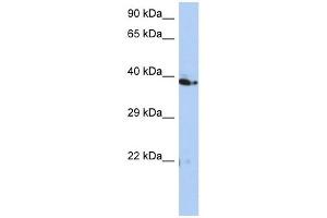 C10ORF46 antibody used at 1 ug/ml to detect target protein. (CACUL1 Antikörper  (Middle Region))