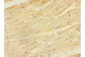 Immunohistochemistry of paraffin-embedded human heart tissue using ABIN7151514 at dilution of 1:100 (EAF2 Antikörper  (AA 1-170))
