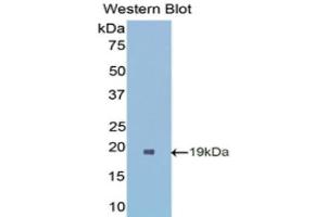 Western Blotting (WB) image for anti-Superoxide Dismutase 1, Soluble (SOD1) (AA 2-154) antibody (ABIN1078539) (SOD1 Antikörper  (AA 2-154))