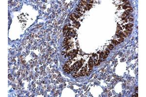 IHC-P Image MTMR9 antibody [C3], C-term detects MTMR9 protein at cytoplasm on mouse lung by immunohistochemical analysis. (MTMR9 Antikörper  (C-Term))