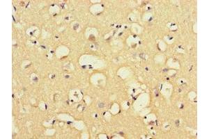 Immunohistochemistry of paraffin-embedded human brain tissue using ABIN7160057 at dilution of 1:100 (MAP3K8 Antikörper  (AA 1-300))