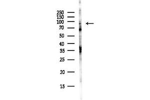anti-X-Ray Radiation Resistance Associated 1 (XRRA1) antibody