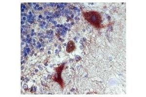 Calbindin 1 in Purkinje neurons in human cerebellum was detected using HRP/DAB brown color stain (CALB1 Antikörper  (C-Term))