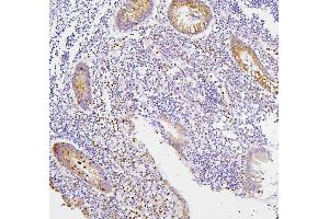 IHC analysis of CXCR2 using anti-CXCR2 antibody (ABIN7601315). (CXCR2 Antikörper  (AA 32-54))
