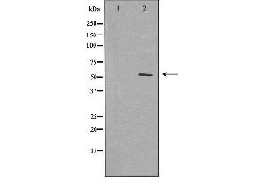 Western blot analysis of extracts from HUVEC cells using PFKFB1 antibody. (PFKFB1 Antikörper  (C-Term))