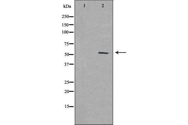 PFKFB1 antibody  (C-Term)