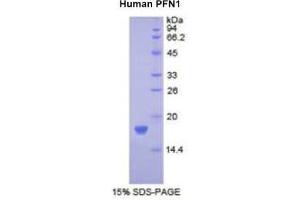 SDS-PAGE (SDS) image for Profilin 1 (PFN1) (AA 1-139) protein (His tag) (ABIN1878029)