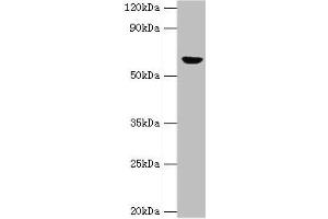 Western blot All lanes: GLUD2 antibody at 2 μg/mL + 293T whole cell lysate Secondary Goat polyclonal to rabbit IgG at 1/10000 dilution Predicted band size: 61 kDa Observed band size: 61 kDa (GLUD2 Antikörper  (AA 319-558))