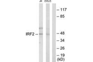 Western blot analysis of extracts from Jurkat/COLO205 cells, using IRF2 Antibody.