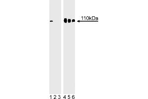 Western Blotting (WB) image for anti-Retinoblastoma 1 (RB1) (pSer780) antibody (ABIN967604) (Retinoblastoma 1 Antikörper  (pSer780))
