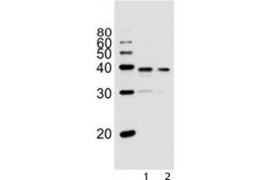 Western blot analysis of lysate from 1) PC3, and 2) LNCaP cell line using VDR antibody at 1:1000. (Vitamin D Receptor Antikörper  (AA 274-299))