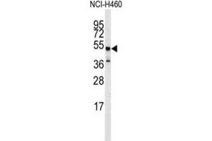 Western Blotting (WB) image for anti-Adrenergic, beta-2-, Receptor, Surface (ADRB2) antibody (ABIN3003093) (beta 2 Adrenergic Receptor Antikörper)