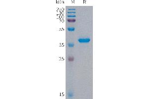 SDS-PAGE (SDS) image for S100 Calcium Binding Protein A9 (S100A9) protein (Fc Tag) (ABIN7491509)