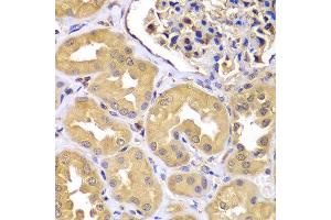 Immunohistochemistry of paraffin-embedded human kidney using LZTR1 antibody at dilution of 1:100 (x400 lens).