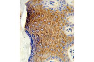 Formalin-fixed and paraffin-embedded human skin tissue reacted with GALNT3 Antibody (Center), which was peroxidase-conjugated to the secondary antibody, followed by DAB staining. (GALNT3 Antikörper  (AA 454-481))