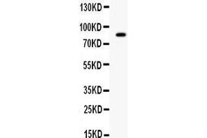 Western blot analysis of SMURF2 expression in SMMC whole cell lysates (lane 1). (SMURF2 Antikörper  (Middle Region))