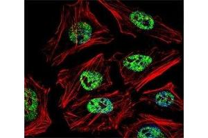 Fluorescent confocal image of HeLa cell stained with NANOG antibody at 1:25. (Nanog Antikörper  (AA 15-49))