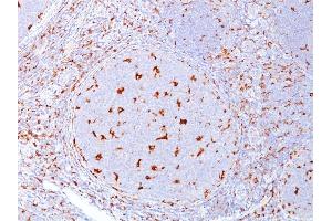 Immunohistochemistry (IHC) image for anti-CD68 Molecule (CD68) antibody (ABIN6941241)