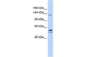 PUM2 antibody used at 1 ug/ml to detect target protein. (PUM2 Antikörper)