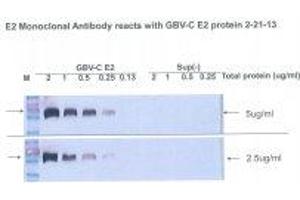 Image no. 1 for anti-Glycoprotein E2 antibody (ABIN1742586) (Glycoprotein E2 Antikörper)