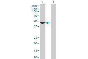 Lane 1: RAD51C transfected lysate ( 42. (RAD51C 293T Cell Transient Overexpression Lysate(Denatured))