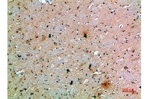 Immunohistochemical analysis of paraffin-embedded human-brain, antibody was diluted at 1:200 (PDGFC Antikörper  (AA 61-110))