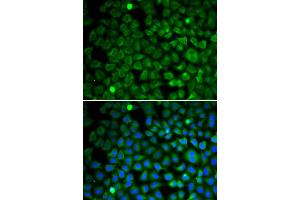 Immunofluorescence analysis of U2OS cells using NUP62 antibody. (NUP62 Antikörper)