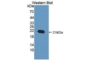Detection of Recombinant ACD, Mouse using Polyclonal Antibody to Adrenocortical Dysplasia Homolog (ACD) (ACD Antikörper  (AA 21-175))