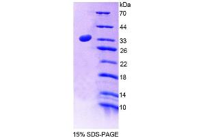 SDS-PAGE (SDS) image for Latrophilin 2 (LPHN2) (AA 139-398) protein (His tag) (ABIN6238683)