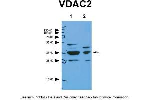 WB Suggested Anti-VDAC2 Antibody    Titration:  1.