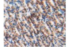 Immunohistochemistry (IHC) image for anti-Dihydrolipoamide Dehydrogenase (DLD) (AA 238-466) antibody (ABIN1858649)