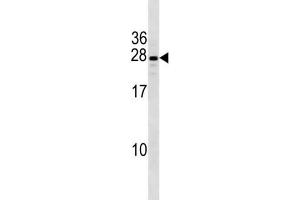 Western Blotting (WB) image for anti-PIH1 Domain Containing 3 (PIH1D3) antibody (ABIN3004440) (PIH1D3 Antikörper)