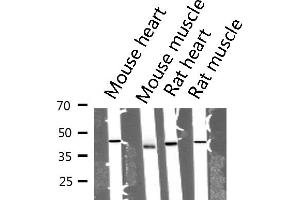 Western blot analysis of extracts from mouse tissue sample, using Actin α 1 Antibody. (Actin Antikörper  (N-Term))