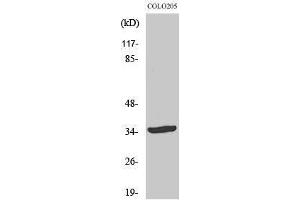 Western Blotting (WB) image for anti-Ubiquitin Thioesterase OTU1 (YOD1) (Internal Region) antibody (ABIN3186223) (YOD1 Antikörper  (Internal Region))