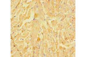 Immunohistochemistry of paraffin-embedded human heart tissue using ABIN7158138 at dilution of 1:100 (LRRC15 Antikörper  (AA 301-538))