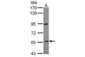 Image no. 1 for anti-Cytochrome P450, Family 4, Subfamily F, Polypeptide 12 (CYP4F12) (AA 133-322) antibody (ABIN1497740) (CYP4F12 Antikörper  (AA 133-322))