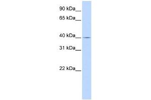 SLC22A18 antibody used at 1 ug/ml to detect target protein.