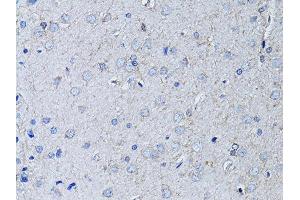 Immunohistochemistry of paraffin-embedded rat brain using RYR2 Antibody (ABIN5970123) at dilution of 1/100 (40x lens). (RYR2 Antikörper)