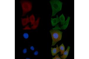 ABIN6259569 and ABIN6275413 staining Hela cells by IF/ICC.