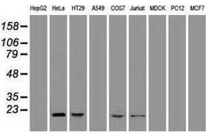 Western blot analysis of extracts (35 µg) from 9 different cell lines by using anti-AK1 monoclonal antibody. (Adenylate Kinase 1 Antikörper)