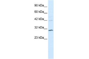 WB Suggested Anti-HOXB5 Antibody Titration: 0.