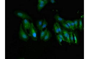 Immunofluorescent analysis of Hela cells using ABIN7174631 at dilution of 1:100 and Alexa Fluor 488-congugated AffiniPure Goat Anti-Rabbit IgG(H+L) (UGT1A9 Antikörper  (AA 277-473))