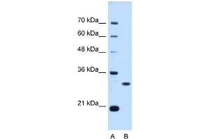 PSME3 antibody used at 0. (PSME3 Antikörper  (N-Term))