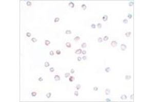Immunocytochemistry of SCUBE2 in Daudi cells with SCUBE2 antibody at 20 μg/ml. (SCUBE2 Antikörper  (Center))