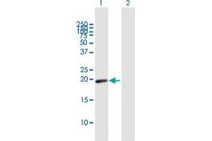 Western Blot analysis of MYL7 expression in transfected 293T cell line by MYL7 MaxPab polyclonal antibody. (MYL7 Antikörper  (AA 1-175))