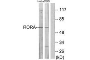 Western blot analysis of extracts from HeLa/COS7 cells, using RORA Antibody. (RORA Antikörper  (AA 6-55))