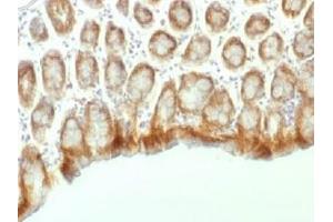Immunohistochemistry (IHC) image for anti-Catenin, beta (CATNB) antibody (ABIN4949465)
