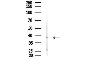 anti-CD1e (CD1e) antibody