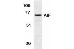 Western blot analysis of AIF in K562 cell lysate with AP30029PU-N AIF antibody at 1 μg/ml. (AIF Antikörper  (N-Term))