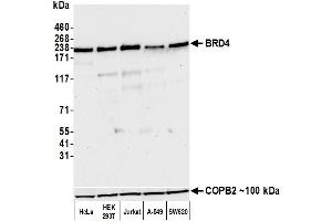 Western Blotting (WB) image for anti-Bromodomain Containing 4 (BRD4) (AA 1312-1362) antibody (ABIN7454019)